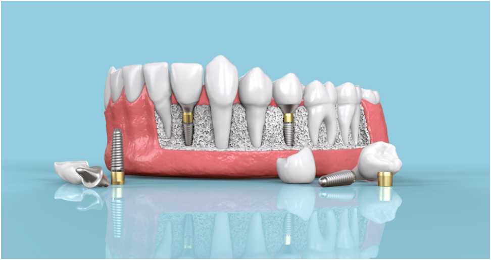 Exploring Advanced Oral Care Treatments: What’s New in Dentistry?